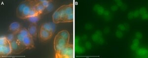 Anti-RAR&#947;1 Antibody, clone 1C22 ZooMAb&#174; Rabbit Monoclonal recombinant, expressed in HEK 293 cells