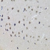Anti-STAT1 antibody produced in rabbit