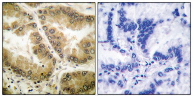 Anti-HDAC7 antibody produced in rabbit affinity isolated antibody