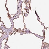Anti-CAV1 antibody produced in rabbit Prestige Antibodies&#174; Powered by Atlas Antibodies, affinity isolated antibody, buffered aqueous glycerol solution