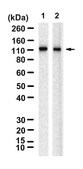 Anti-TRPV4 Antibody, clone 1G10-L2 ZooMAb&#174; Rabbit Monoclonal recombinant, expressed in HEK 293 cells