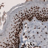Monoclonal Anti-PARP1 Prestige Antibodies&#174; Powered by Atlas Antibodies, clone CL2209, purified immunoglobulin, buffered aqueous glycerol solution