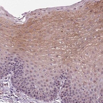 Anti-TPRG1 antibody produced in rabbit Prestige Antibodies&#174; Powered by Atlas Antibodies, affinity isolated antibody, buffered aqueous glycerol solution