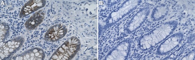 Anti-OLFM4/Olfactomedin-4 Antibody, clone 1B10 ZooMAb&#174; Rabbit Monoclonal recombinant, expressed in HEK 293 cells