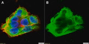 Anti-&#946;2-Adrenergic Receptor Antibody, clone 2B23 ZooMAb&#174; Rabbit Monoclonal recombinant, expressed in HEK 293 cells
