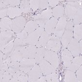 Anti-SLC6A1 antibody produced in rabbit Prestige Antibodies&#174; Powered by Atlas Antibodies, affinity isolated antibody, buffered aqueous glycerol solution