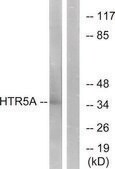Anti-HTR5A antibody produced in rabbit affinity isolated antibody