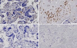 Anti-p57Kip2 Antibody, clone 1H11 ZooMAb&#174; Rabbit Monoclonal recombinant, expressed in HEK 293 cells