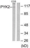 Anti-PYK2 antibody produced in rabbit affinity isolated antibody