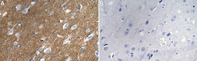 Anti-MAL2 Antibody, clone 1K18 ZooMAb&#174; Rabbit Monoclonal recombinant, expressed in HEK 293 cells