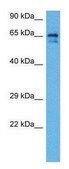 Anti-SLC6A2 antibody produced in rabbit affinity isolated antibody