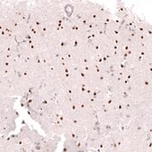 Monoclonal Anti-Bcl11A Antibody Produced In Mouse Prestige Antibodies&#174; Powered by Atlas Antibodies, clone CL13530, affinity isolated antibody, buffered aqueous glycerol solution