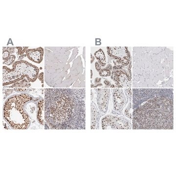 Anti-SMARCC1 antibody produced in rabbit Prestige Antibodies&#174; Powered by Atlas Antibodies, affinity isolated antibody, buffered aqueous glycerol solution