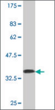 Monoclonal Anti-CHAT antibody produced in mouse clone 1H7, purified immunoglobulin, buffered aqueous solution