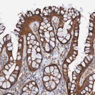 Anti-ST8SIA6 antibody produced in rabbit Prestige Antibodies&#174; Powered by Atlas Antibodies, affinity isolated antibody, buffered aqueous glycerol solution