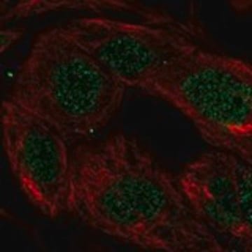 Anti-SKIL antibody produced in rabbit Prestige Antibodies&#174; Powered by Atlas Antibodies, affinity isolated antibody, buffered aqueous glycerol solution