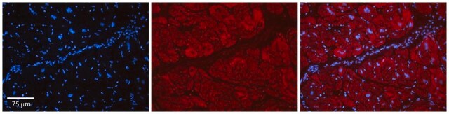 Anti-PARP16 antibody produced in rabbit affinity isolated antibody