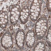 Monoclonal Anti-LAMB2 antibody produced in mouse Prestige Antibodies&#174; Powered by Atlas Antibodies, clone CL2976, purified immunoglobulin, buffered aqueous glycerol solution