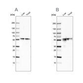 Anti-FGB antibody produced in rabbit Ab2, Prestige Antibodies&#174; Powered by Atlas Antibodies, affinity isolated antibody, buffered aqueous glycerol solution
