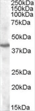 Anti-PITX3 antibody produced in goat affinity isolated antibody, buffered aqueous solution