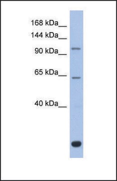 Anti-BACH2 antibody produced in rabbit affinity isolated antibody