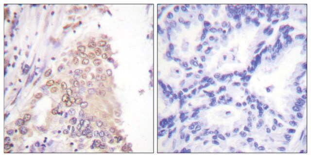Anti-AML1 antibody produced in rabbit affinity isolated antibody