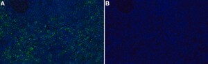 Anti-ERK5 Antibody, clone 2H15 ZooMAb&#174; Rabbit Monoclonal recombinant, expressed in HEK 293 cells