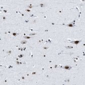 Anti-TOP1 antibody produced in rabbit Prestige Antibodies&#174; Powered by Atlas Antibodies, affinity isolated antibody, buffered aqueous glycerol solution