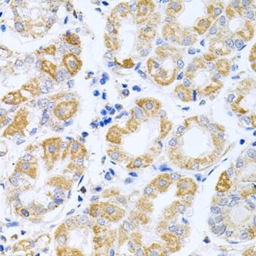 Anti-IRS1 antibody produced in rabbit