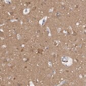 Anti-CAMK2D antibody produced in rabbit Prestige Antibodies&#174; Powered by Atlas Antibodies, affinity isolated antibody, buffered aqueous glycerol solution