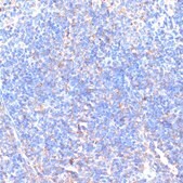 Anti-MMP9 antibody produced in rabbit