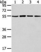 Anti-TUBA1C affinity isolated antibody