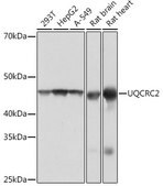 Anti-UQCRC2 antibody produced in rabbit