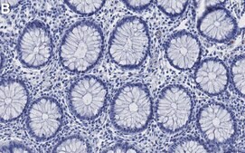 Anti-RET Antibody, clone 2K12 ZooMAb&#174; Rabbit Monoclonal recombinant, expressed in HEK 293 cells