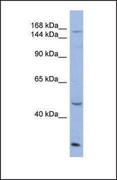 Anti-ATP7A antibody produced in rabbit affinity isolated antibody