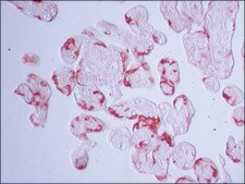 Anti-Transglutaminase-2 (C-terminal) antibody produced in rabbit ~1.5&#160;mg/mL, affinity isolated antibody