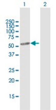 Anti-CYP46A1 antibody produced in rabbit purified immunoglobulin, buffered aqueous solution