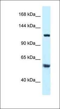 Anti-TBCD antibody produced in rabbit affinity isolated antibody