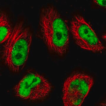 Anti-USP22 antibody produced in rabbit Prestige Antibodies&#174; Powered by Atlas Antibodies, affinity isolated antibody, buffered aqueous glycerol solution