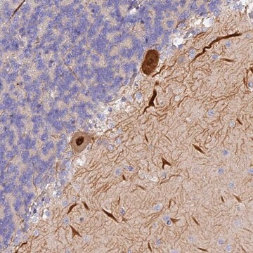 Anti-TRIM3 antibody produced in rabbit Prestige Antibodies&#174; Powered by Atlas Antibodies, affinity isolated antibody, buffered aqueous glycerol solution