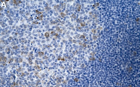 Anti-RRM1 Antibody, clone 1E20 ZooMAb&#174; Rabbit Monoclonal recombinant, expressed in HEK 293 cells