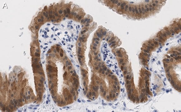 Anti-Angiopoietin-1 Antibody, clone 2F9 ZooMAb&#174; Rabbit Monoclonal recombinant, expressed in HEK 293 cells