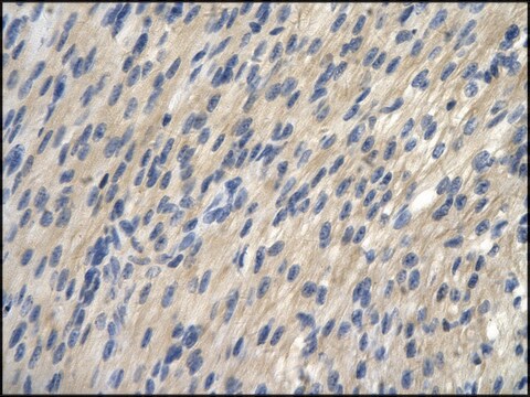 Anti-TRIP13 (AB1) antibody produced in rabbit IgG fraction of antiserum