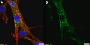 Anti-Neprilysin/CD10 Antibody, clone 1C22 ZooMAb&#174; Rabbit Monoclonal recombinant, expressed in HEK 293 cells