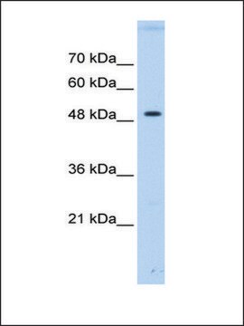 Anti-PTPN1 antibody produced in rabbit affinity isolated antibody