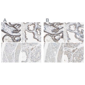 Anti-B4GALT1 antibody produced in rabbit Ab2, Prestige Antibodies&#174; Powered by Atlas Antibodies, affinity isolated antibody, buffered aqueous glycerol solution