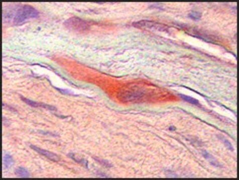 Anti-CSF1 antibody produced in rabbit affinity isolated antibody