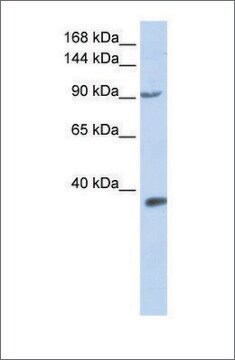 Anti-EPAS1 antibody produced in rabbit affinity isolated antibody