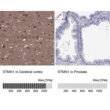 Anti-STMN1 antibody produced in rabbit Prestige Antibodies&#174; Powered by Atlas Antibodies, affinity isolated antibody, buffered aqueous glycerol solution