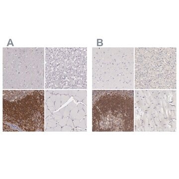 Anti-ARHGAP4 antibody produced in rabbit Ab1, Prestige Antibodies&#174; Powered by Atlas Antibodies, affinity isolated antibody, buffered aqueous glycerol solution